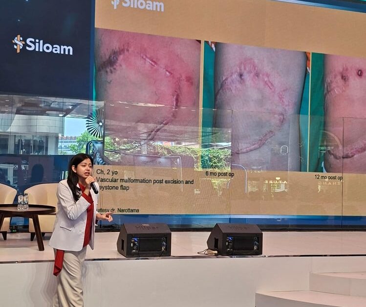 Perdana Bedah Plastik, Rekonstruksi dan Estetik dengan Standar Korea Selatan di Siloam Hospital TB Simatupang